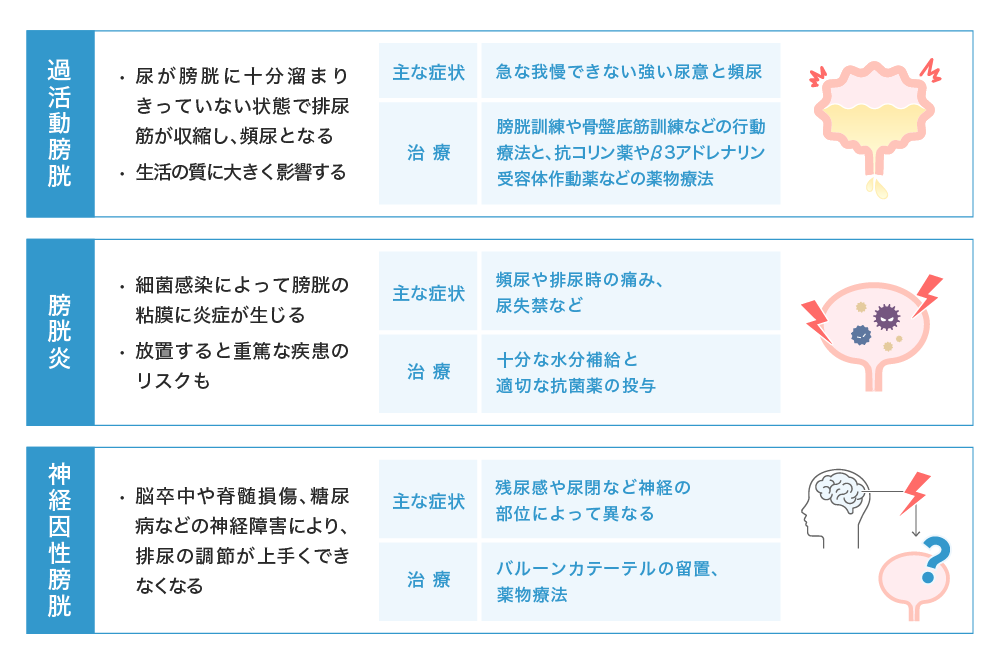 過活動膀胱 ·尿が膀胱に十分溜まりきっていない状態で排尿筋が収縮し、頻尿となる ·生活の質に大きく影響する 主な症状 急な我慢できない強い尿意と頻尿 治療 膀胱訓練や骨盤底筋訓練などの行動療法と、抗コリン薬やβ3アドレナリン受容体作動薬などの薬物療法 膀胱炎 ·細菌感染によって膀胱の粘膜に炎症が生じる ·放置すると重篤な疾患のリスクも 主な症状 頻尿や排尿時の痛み、尿失禁など 治療 十分な水分補給と適切な抗菌薬の投与 神経因性膀胱 ·脳卒中や脊髄損傷、糖尿病などの神経障害により、排尿の調節が上手くできなくなる 主な症状 残尿感や尿閉など神経の部位によって異なる 治療 バルーンカテーテルの留置、薬物療法