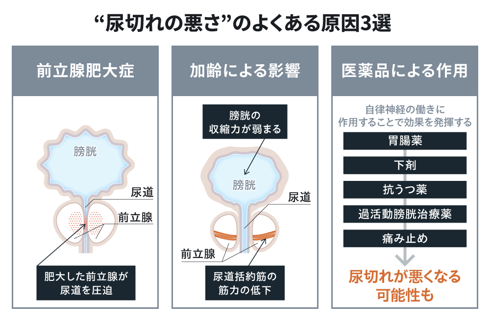 &ldquo;尿切れの悪さ&rdquo;のよくある原因3選　前立腺肥大症 肥大した前立腺が尿道を圧迫　加齢による影響 膀胱の収縮力が弱まる 尿道括約筋の筋力の低下　医薬品による作用 自律神経の働きに作用することで効果を発揮する 胃腸薬&rarr;下剤&rarr;抗うつ薬&rarr;過活動膀胱治療薬&rarr;痛み止め&rarr;尿切れが悪くなる可能性も