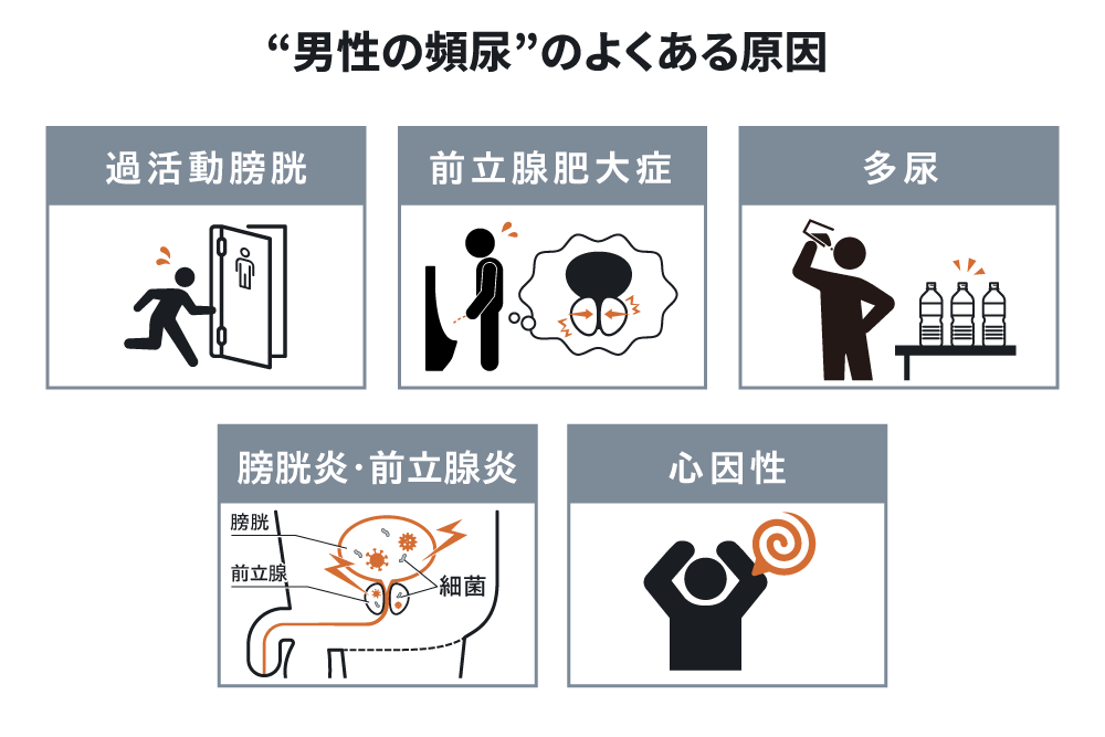 &ldquo;男性の頻尿&rdquo;のよくある原因　過活動膀胱　前立腺肥大症　多尿　膀胱炎&middot;前立腺炎　心因性
