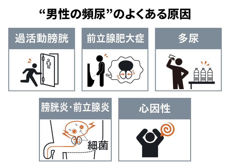 &ldquo;男性の頻尿&rdquo;のよくある原因　過活動膀胱　前立腺肥大症　多尿　膀胱炎&middot;前立腺炎　心因性