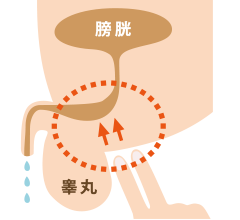 一歩先ゆくちょいモレ対策、「ミルキング」って何？