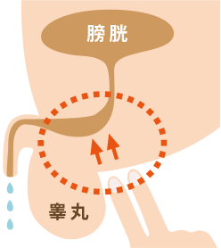 一歩先ゆくちょいモレ対策、「ミルキング」って何？